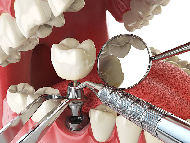 Best Weekend Emergency Dentist in Lone Tree, IA